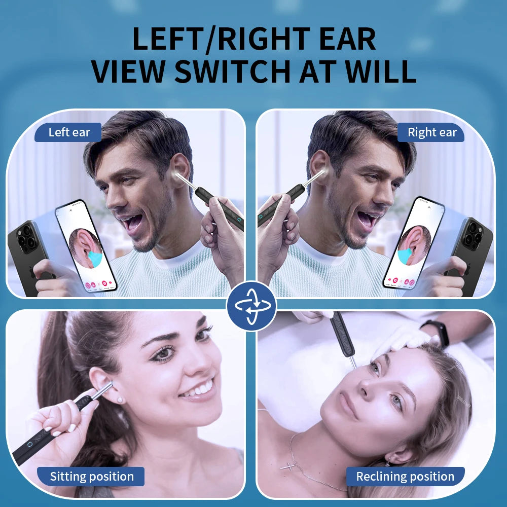 Wireless Ear Wax Cleaner with HD Camera – LED Otoscope & Ear Cleaning Tool