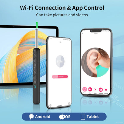 Wireless Ear Wax Cleaner with HD Camera – LED Otoscope & Ear Cleaning Tool