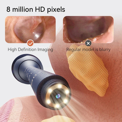 Smart Visual Ear Wax Cleaner with 800W HD Camera – Multi-Functional Ear Cleaning Tool